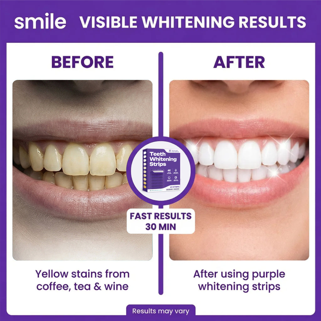 PAP Purple Teeth Whitening Strips – 21-Day Stain Treatment