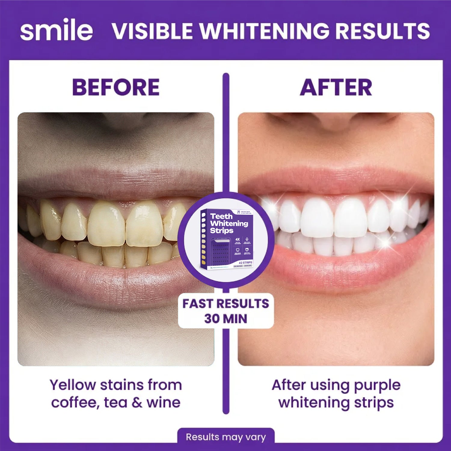 PAP Purple Teeth Whitening Strips – 21-Day Stain Treatment